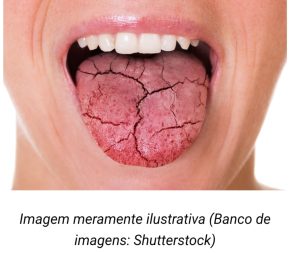 fisiocare-e-saude-artigo-sobre-a-Sjogren